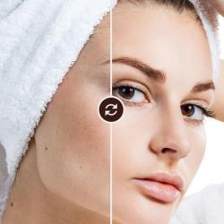 Vorschaubild Absatzmodul Vorher Nachher.